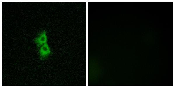 a14444 gpr22 primary antibodies if testing 1