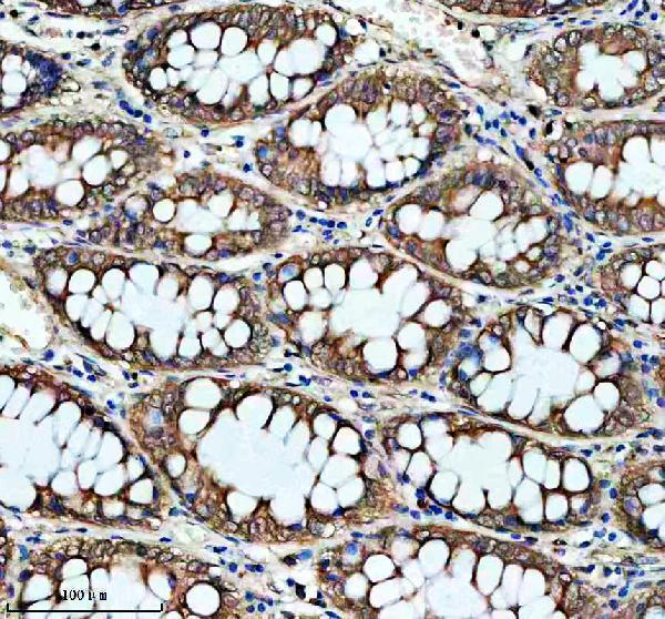 IHC analysis of PIWIL3 using anti-PIWIL3 antibody (A14448-1)