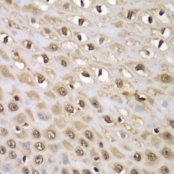 a14452 ints5 primary antiboties ihc testing 2