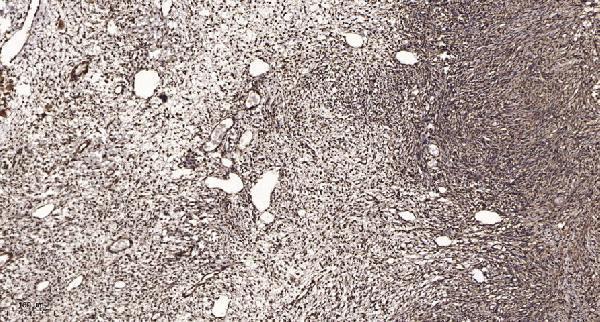 a14458 1 znf436 primary antibodies ihc testing 1