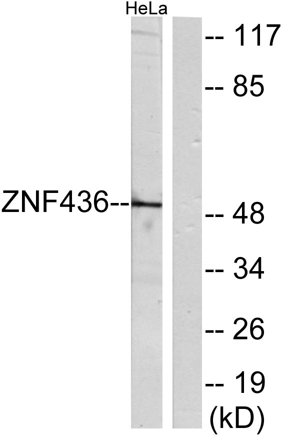 a14458 1 znf436 primary antibodies wb testing 3