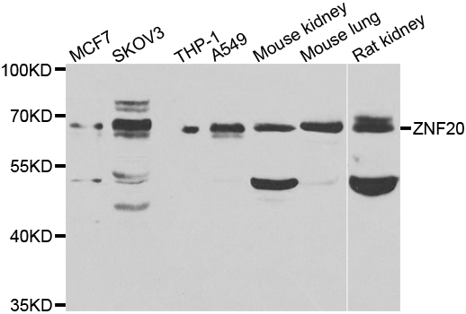 a14461 znf20 primary antiboties wb testing 1