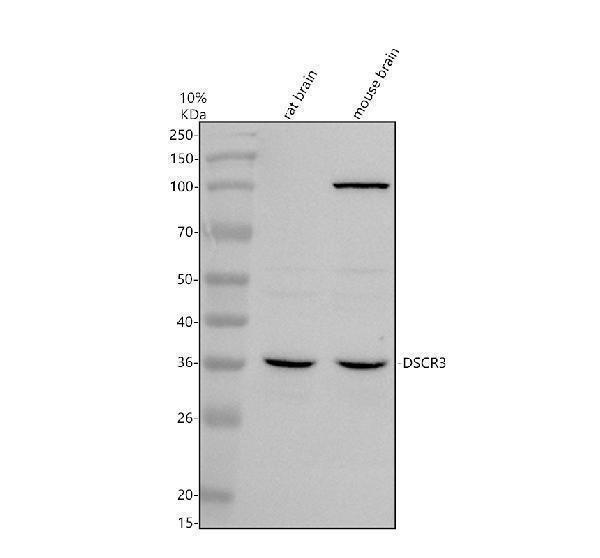 Western blot analysis of DSCR3 using anti-DSCR3 antibody (A14467-1)