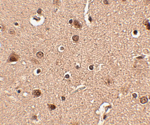 a14468 slitrk4 primary antibodies ihc testing 2