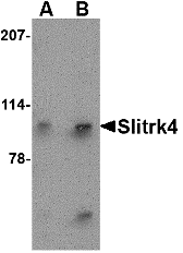 a14468 slitrk4 primary antibodies wb testing 1