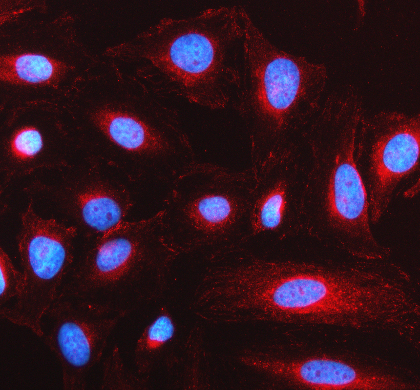 a14471 2 lrp11 primary antibodies if testing 1