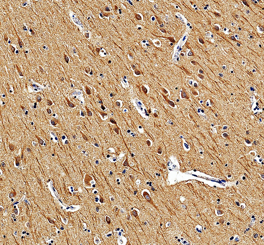 a14471 2 lrp11 primary antibodies ihc testing 1