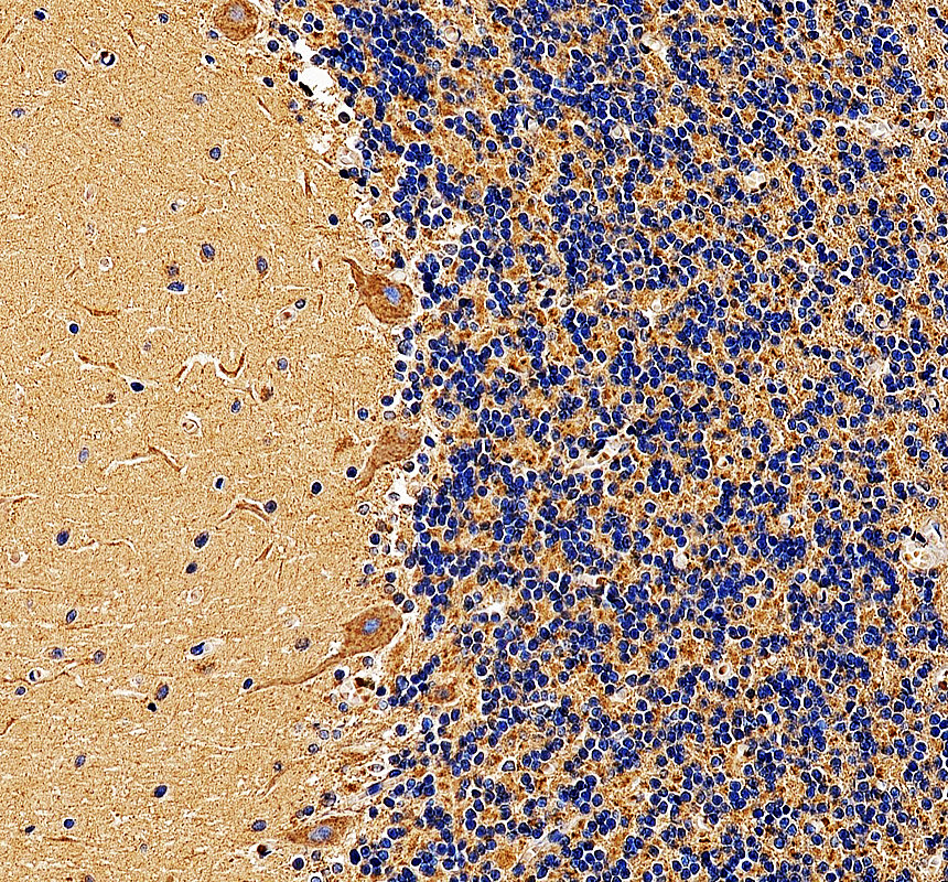 a14471 2 lrp11 primary antibodies ihc testing 2