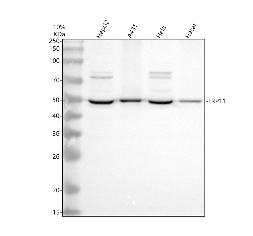 a14471 2 lrp11 primary antibodies wb testing 1