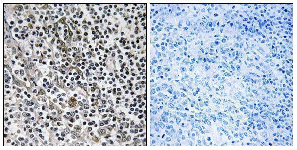 a14477 mrpl51 primary antibodies ihc testing 1