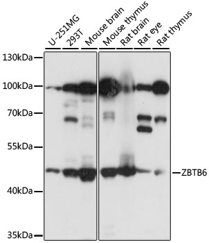 Western blot analysis of extracts of various cell lines, using ZBTB6 antibody  at 1:1000 dilution