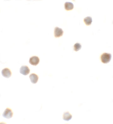 Immunocytochemistry of ZBTB6 in EL4 cells with ZBTB6 antibody at 5 μg/mL