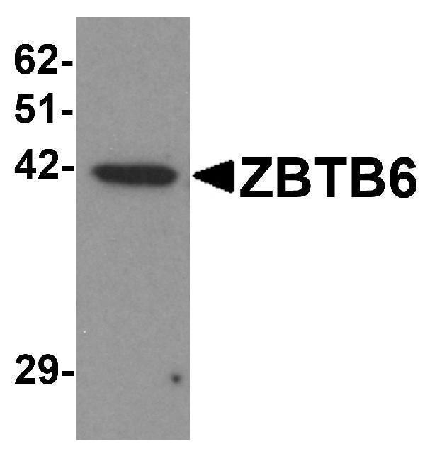 Western blot analysis of ZBTB6 in EL4 cell lysate with ZBTB6 antibody at 1 μg/mL