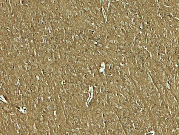 a14492 nap1l5 primary antibodies ihc testing 2