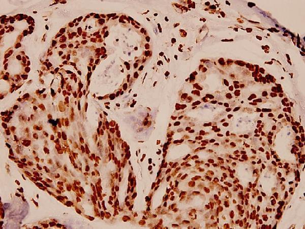 a14495 1 hist1h4a primary antiboties ihc testing 2