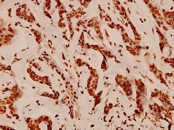 a14495s1 hist1h4a primary antiboties ihc testing 2