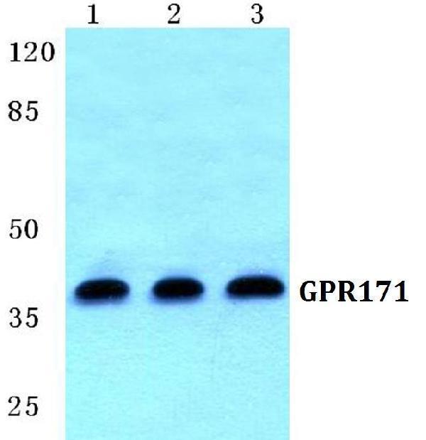 Western blot (WB) analysis of GPR171 polyclonal antibody at 1:500 dilution
Lane1:HEK293T cell lysate
Lane2:Mouse liver tissue lysate
Lane3:Rat liver tissue lysate