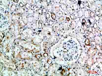 Immunohistochemical analysis of paraffin-embedded human-kidney, antibody was diluted at 1:200