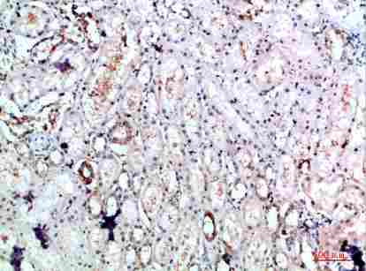 Immunohistochemical analysis of paraffin-embedded human-kidney, antibody was diluted at 1:200