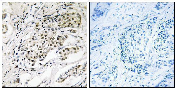 a14503 cdyl2 primary antibodies ihc testing 1