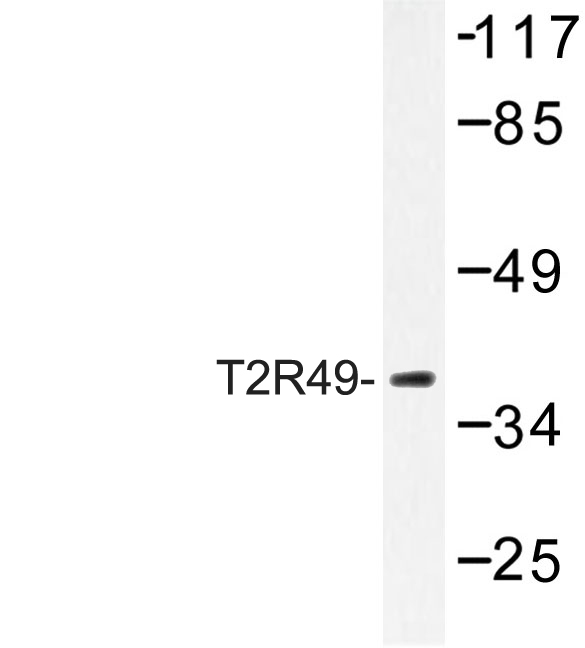 a14508 1 tas2r20 primary antiboties wb testing 1