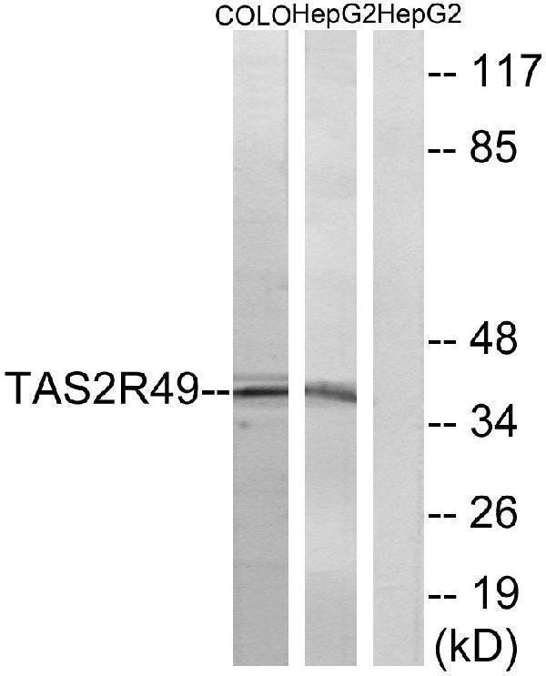 Western blot analysis of lysates from COLO and HepG2 cells, using TAS2R49 Antibody