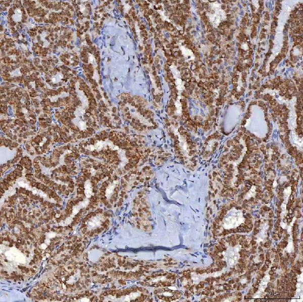 a14512 1 trmt61a primary antibodies ihc testing 11