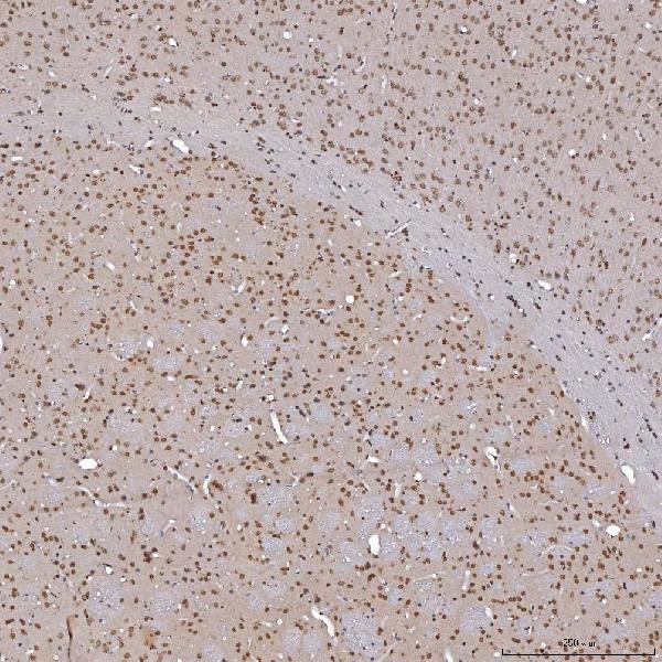 a14512 1 trmt61a primary antibodies ihc testing 12