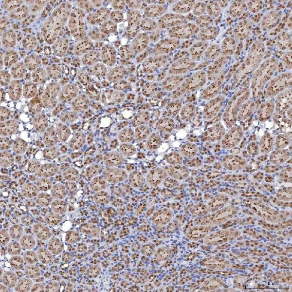 a14512 1 trmt61a primary antibodies ihc testing 13