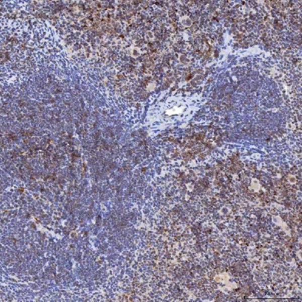 a14512 1 trmt61a primary antibodies ihc testing 14
