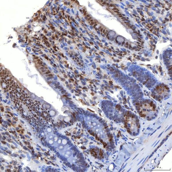 a14512 1 trmt61a primary antibodies ihc testing 15