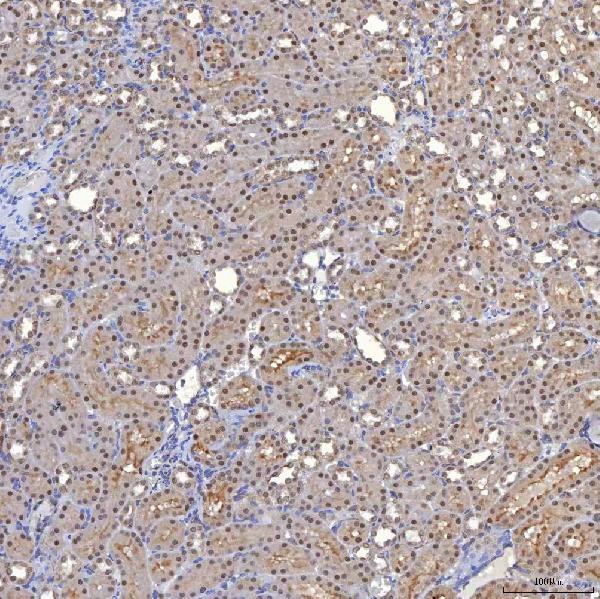 a14512 1 trmt61a primary antibodies ihc testing 16