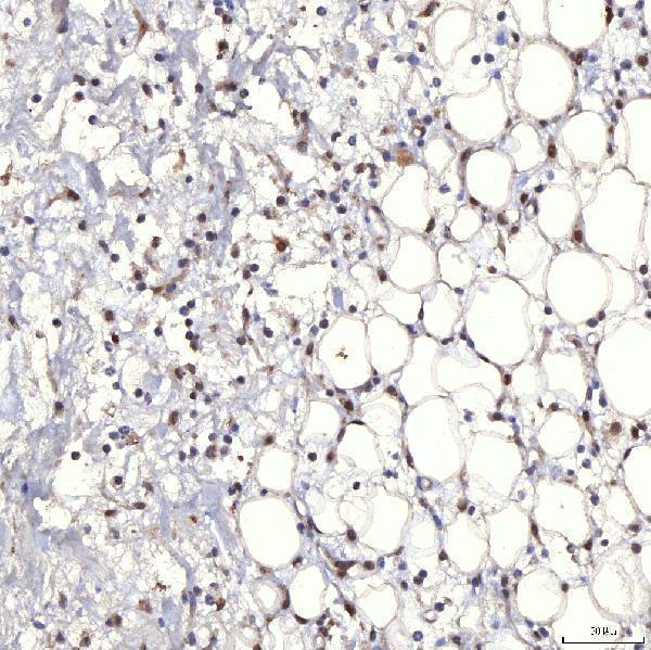 a14512 1 trmt61a primary antibodies ihc testing 17