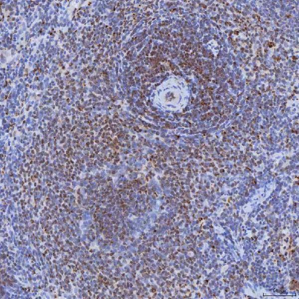 a14512 1 trmt61a primary antibodies ihc testing 18