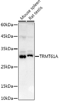 Western blot analysis of extracts of various cell lines, using TRMT61A   antibody  at 1:1000 dilution
