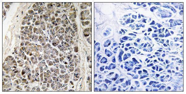 Immunohistochemistry analysis of paraffin-embedded human pancreas tissue, using MRPS21 Antibody