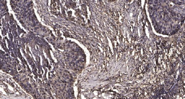 a14516 mrpl47 primary antibodies ihc testing 1
