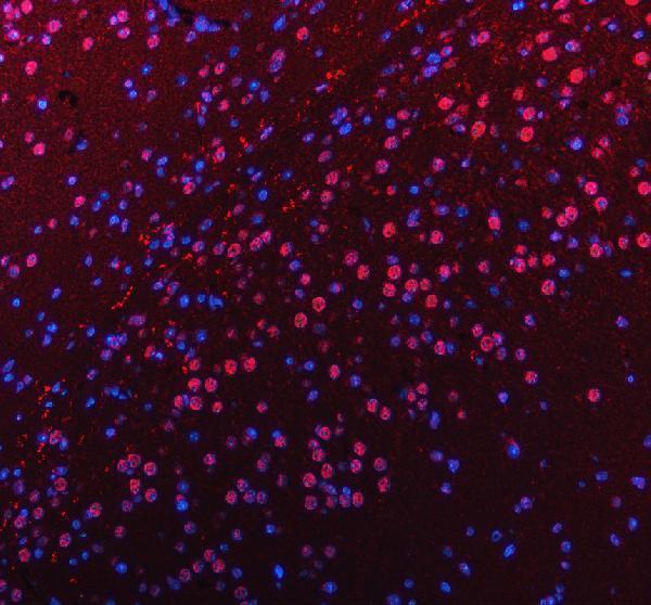 a14523 1 pus7l primary antibodies if testing 1