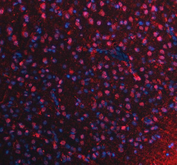a14523 1 pus7l primary antibodies if testing 2