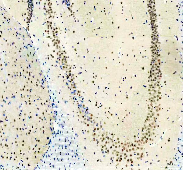 IHC analysis of PUS7L using anti-PUS7L antibody (A14523-1)