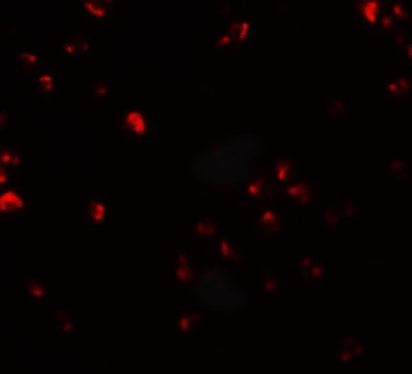Immunofluorescence of FAM193B in Jurkat cells with FAM193B antibody at 20 μg/mL