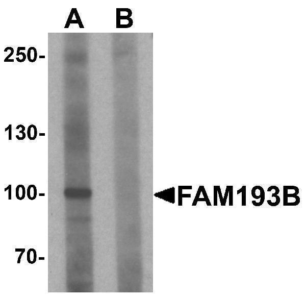 Western blot analysis of FAM193B in Jurkat cell lysate with FAM193B antibody at 1 μg/mL in (A) the absence and (B) the presence of blocking peptide