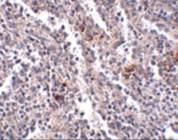 a14531 sypl2 primary antibodies ihc testing 2