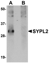 a14531 sypl2 primary antibodies wb testing 1