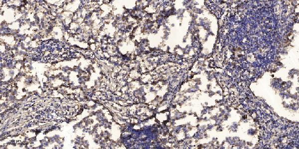 a14533 pabpc5 primary antibodies ihc testing 1