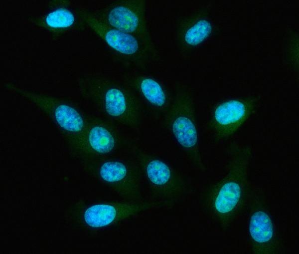 Figure 3. IF analysis of IAH1 using anti-IAH1 antibody (A14534-1). IAH1 was detected in an immunocytochemical section of PC-3 cells. Enzyme antigen retrieval was performed using IHC enzyme antigen retrieval reagent (AR0022) for 15 mins. The cells were blocked with 10% goat serum. And then incubated with 5 microg/mL rabbit anti-IAH1 Antibody (A14534-1) overnight at 4°C. DyLight®488 Conjugated Goat Anti-Rabbit IgG (BA1127) was used as secondary antibody at 1:500 dilution and incubated for 30 minutes at 37°C. The section was counterstained with DAPI. Visualize using a fluorescence microscope and filter sets appropriate for the label used.