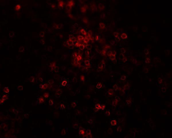 Immunofluorescence of TLX3 in human spleen tissue with TLX3 antibody at 20 μg/ml