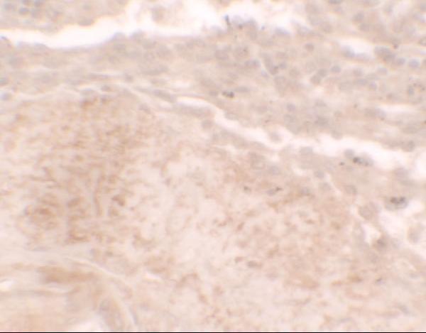 Immunohistochemistry of TLX3 in human spleen tissue with TLX3 antibody at 2