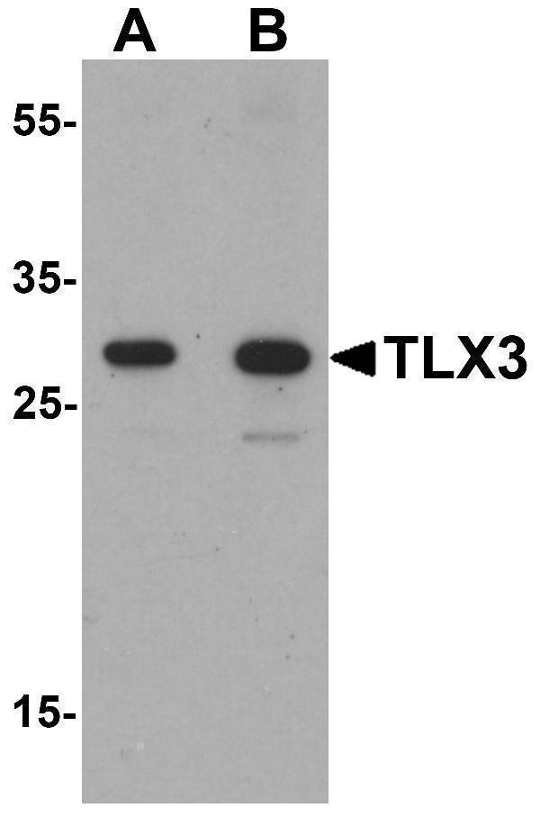 Western blot analysis of TLX3 in human spleen tissue lysate with TLX3 antibody at (A) 0