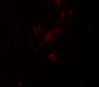 a14543 zbtb5 primary antibodies if testing 3